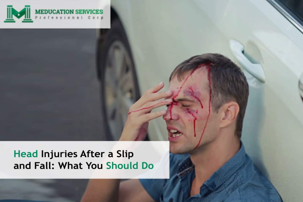 Head Injuries After a Slip and Fall: What You Should Do